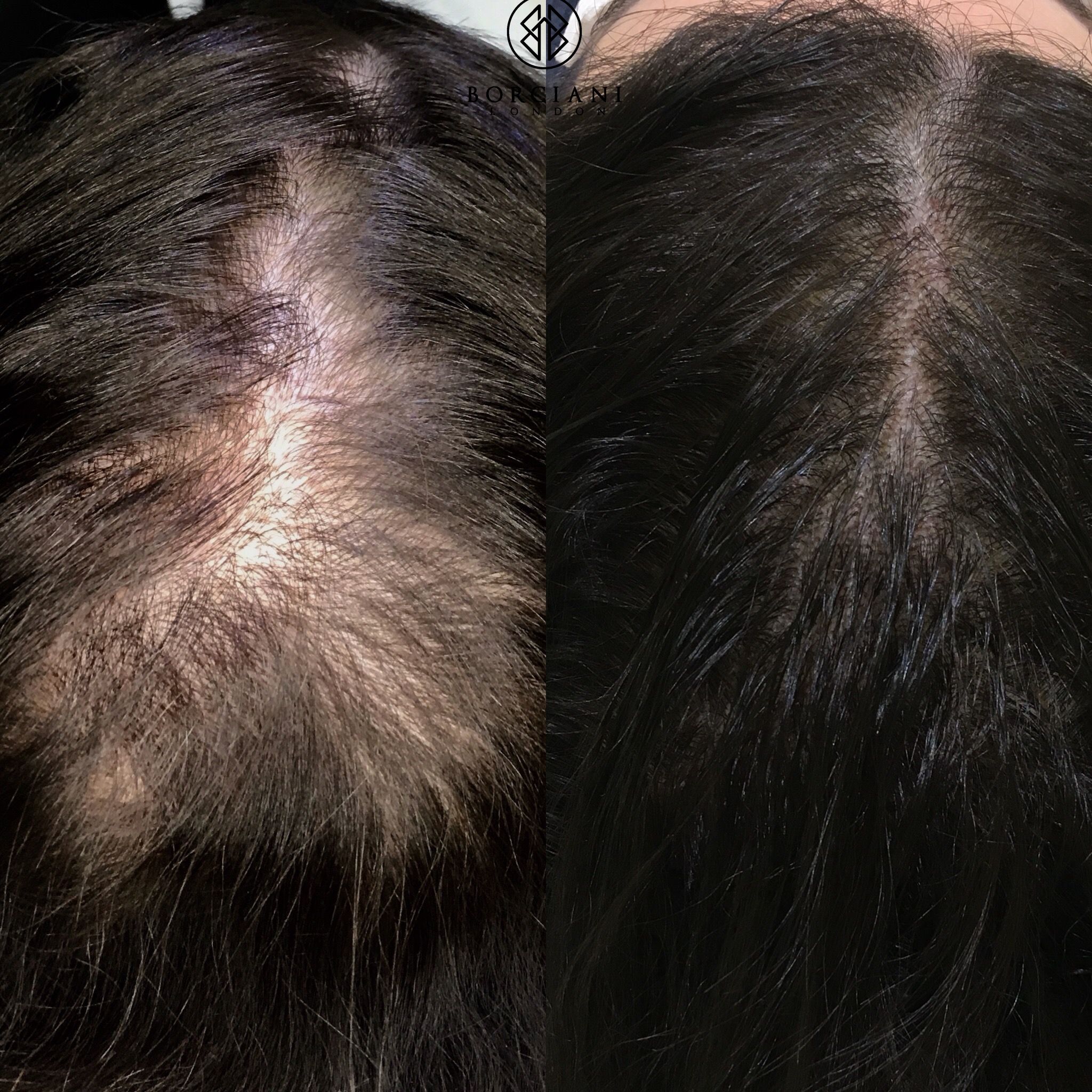 Zakheera Magnesium Oil – 100% Pure for Faster, Stronger Hair Growth - Zakheera 